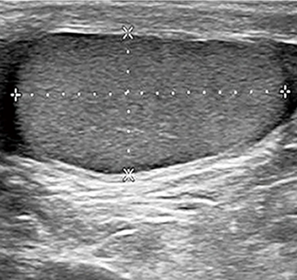 Da Vinchi jinlari filmidan seks sahnalari